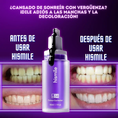 Hismile V34: Tecnología BlanQ™ - Dientes Blancos y Brillantes🦷✨